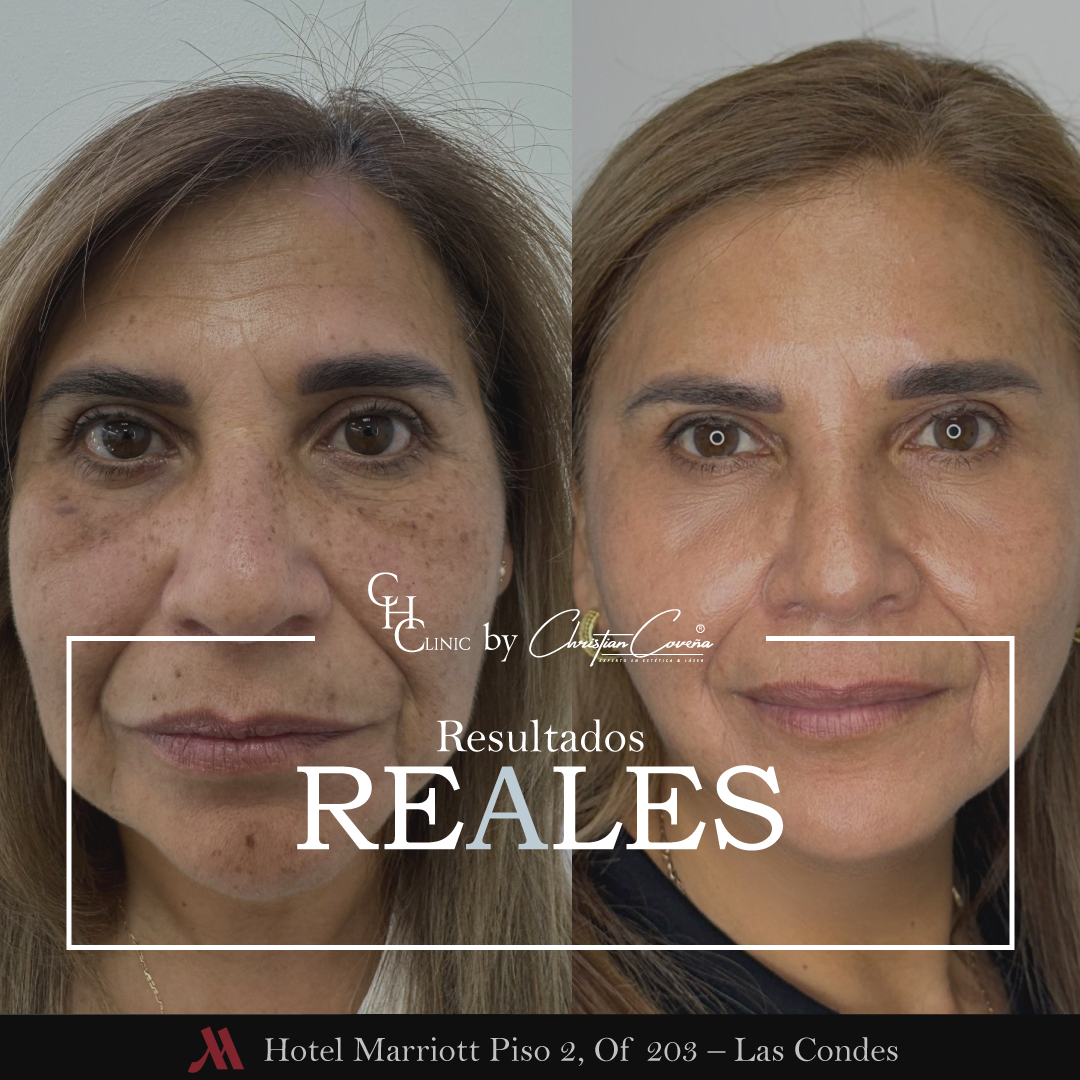 RESULTADOS-REALES